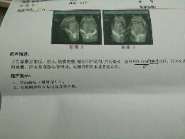 journal_insert_pic_895797928