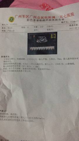 journal_insert_pic_896520735