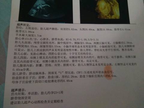 journal_insert_pic_897275191