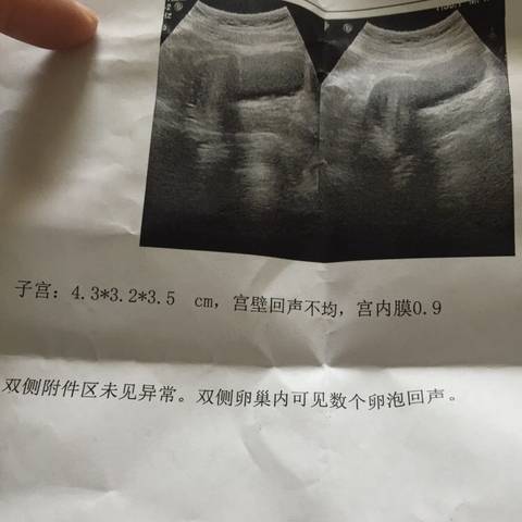 journal_insert_pic_898039750