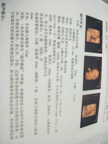 journal_insert_pic_900094476