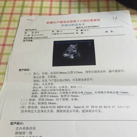 journal_insert_pic_902723463