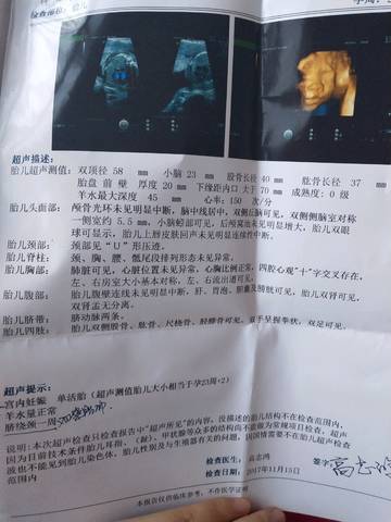 journal_insert_pic_903248353