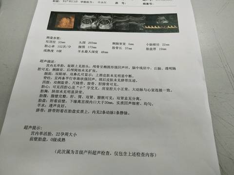 journal_insert_pic_905719630