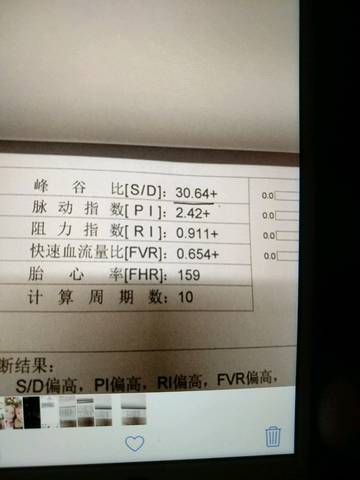 journal_insert_pic_906206412