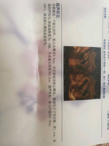 journal_insert_pic_906362703