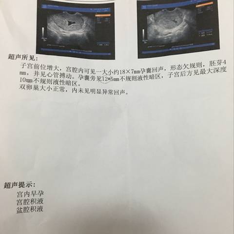 journal_insert_pic_907310658