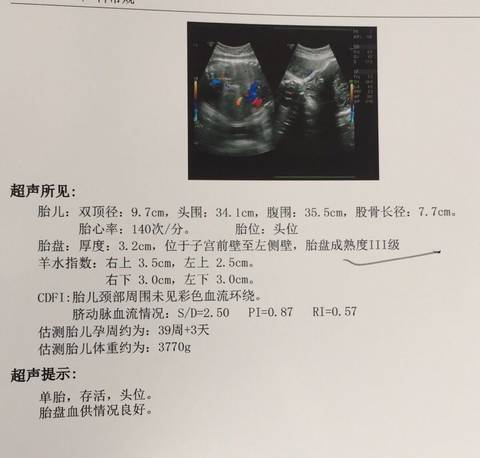 journal_insert_pic_907337253