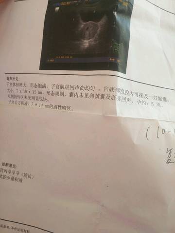 journal_insert_pic_908281307