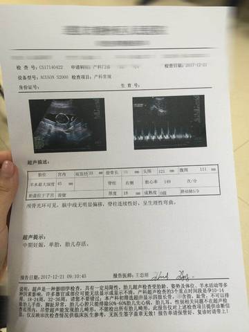 journal_insert_pic_908859613