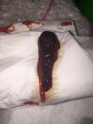 怀孕初期流出一坨血肉图片