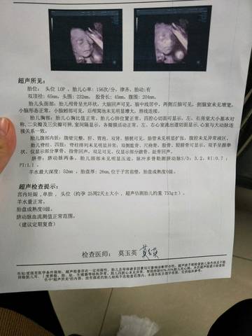 journal_insert_pic_912414633