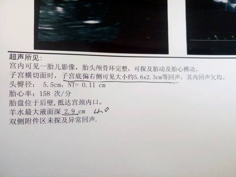 journal_insert_pic_912398217
