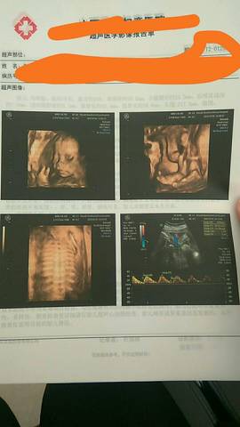 journal_insert_pic_912939122