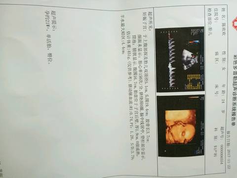 journal_insert_pic_913164636