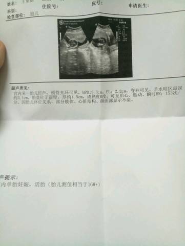 journal_insert_pic_913328966