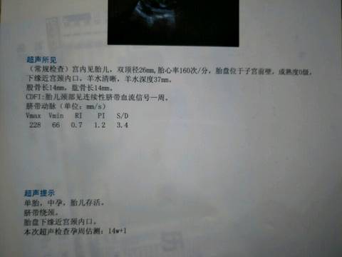 journal_insert_pic_913179698