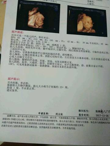 journal_insert_pic_913880341