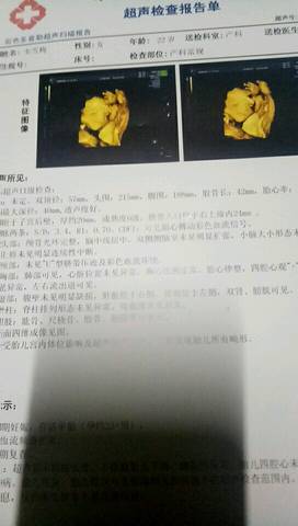 journal_insert_pic_914374868