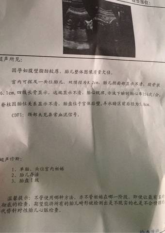 journal_insert_pic_915542469