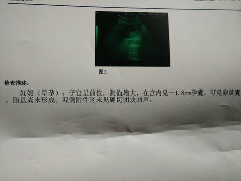 journal_insert_pic_915684729