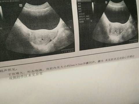 journal_insert_pic_916605207