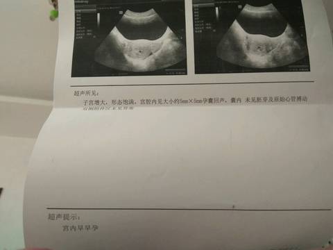 journal_insert_pic_916605042