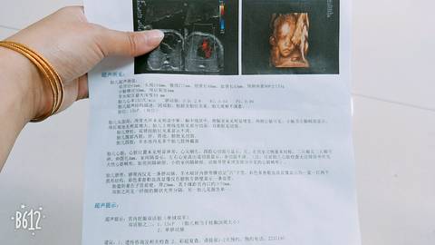 journal_insert_pic_917399679