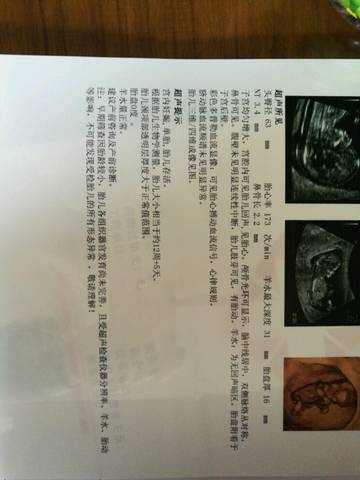 journal_insert_pic_918751835