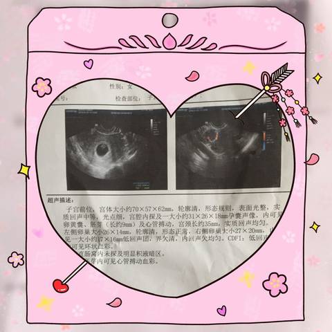 journal_insert_pic_919467121
