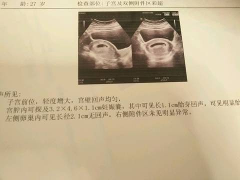 journal_insert_pic_920218311