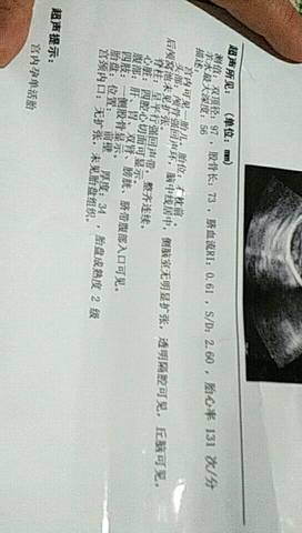 journal_insert_pic_920726397