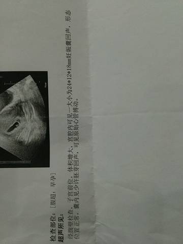 journal_insert_pic_921404262
