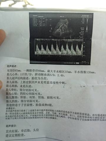 journal_insert_pic_922254555