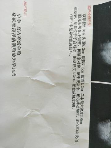 journal_insert_pic_923295935