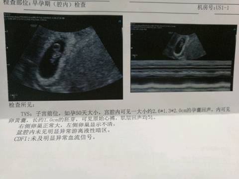 journal_insert_pic_923965003