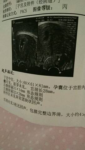 journal_insert_pic_927160838