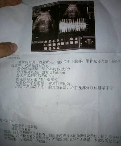 journal_insert_pic_927280851