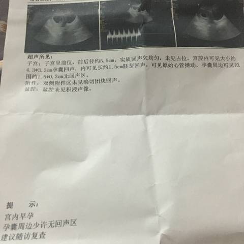 journal_insert_pic_927488423