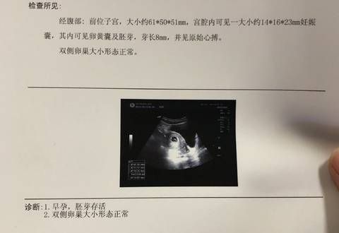 journal_insert_pic_928254396