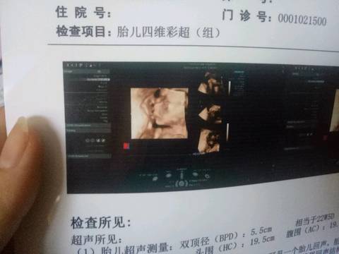 journal_insert_pic_928500232