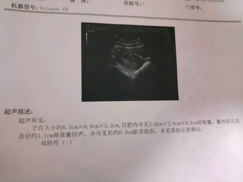 journal_insert_pic_929505275