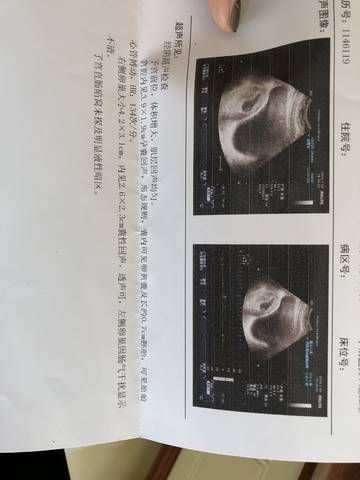journal_insert_pic_929134073