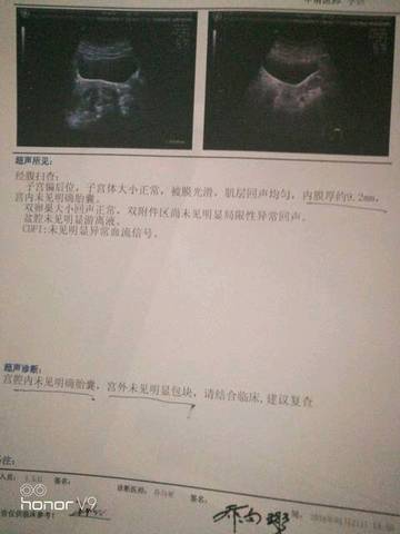 journal_insert_pic_929928233