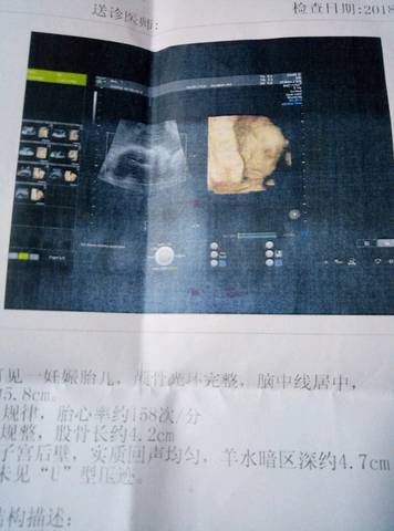 journal_insert_pic_930630554