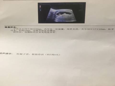 journal_insert_pic_930570043