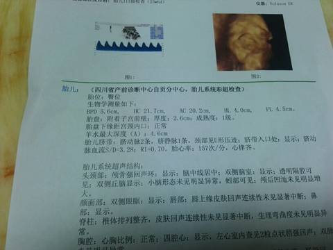 journal_insert_pic_930652077