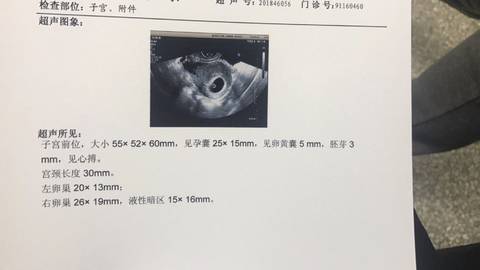 journal_insert_pic_931231223