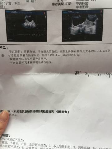 journal_insert_pic_931860935