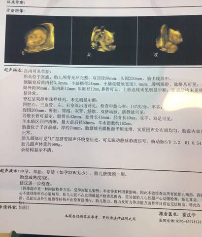 journal_insert_pic_931889803